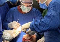 نجات جوان ۲۸ ساله پس از تصادف شدید در زاهدان / ۴ ساعت جراحی برای ترمیم آسیب‌های صورت